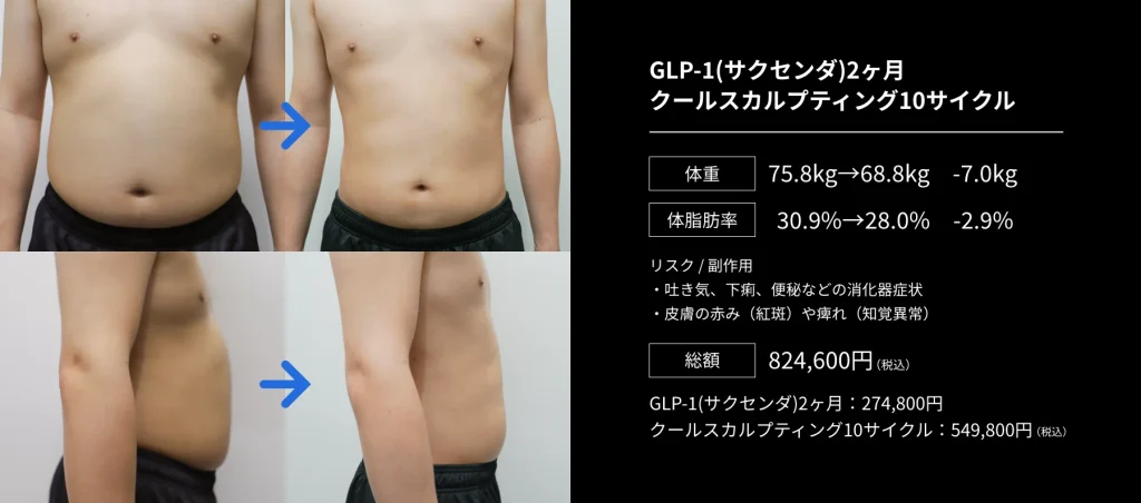 クールスカルプディングを受けた男性写真